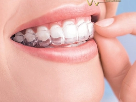INVISALIGN